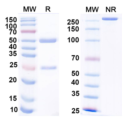 Anti-Human CD66e/CEA/CEACAM5 Monoclonal Antibody (1A267)