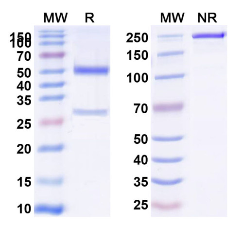 Anti-Human SP10/ACRV1 Monoclonal Antibody (1A411) Anti-Human SP10/ACRV1 Monoclonal Antibody (1A411)