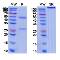 Anti-IL6 Monoclonal antibody (10G10)