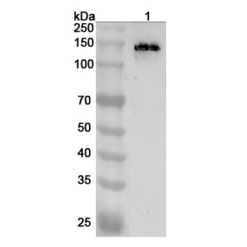 Anti-ABCC8 Polyclonal Antibody