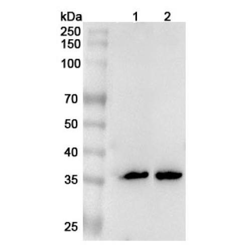 Anti-FCN1 Polyclonal Antibody