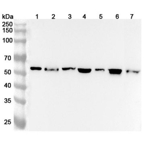 Anti-FGB/Fibrinogen beta Polyclonal Antibody Anti-FGB/Fibrinogen beta Polyclonal Antibody