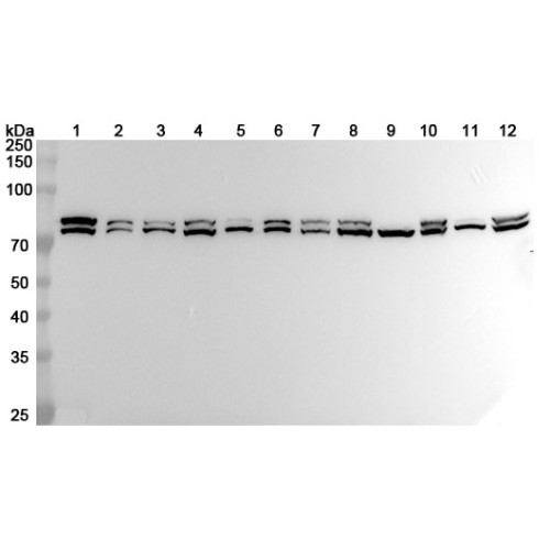 Anti-HSPA5 Polyclonal Antibody