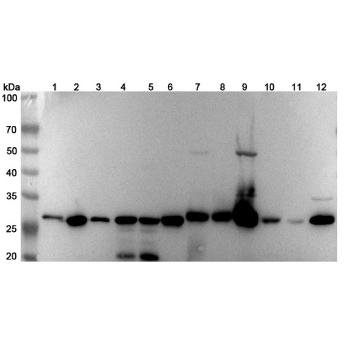 Anti-Human CHCHD3 Polyclonal Antibody Anti-Human CHCHD3 Polyclonal Antibody