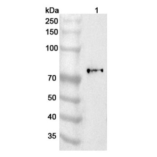 Anti-Human F13B Polyclonal Antibody
