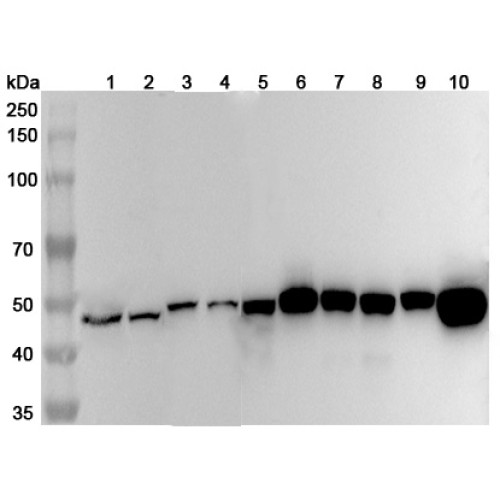 Anti-Human FEN1 Polyclonal Antibody Anti-Human FEN1 Polyclonal Antibody