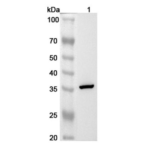 Anti-Human GNPDA1 Polyclonal Antibody
