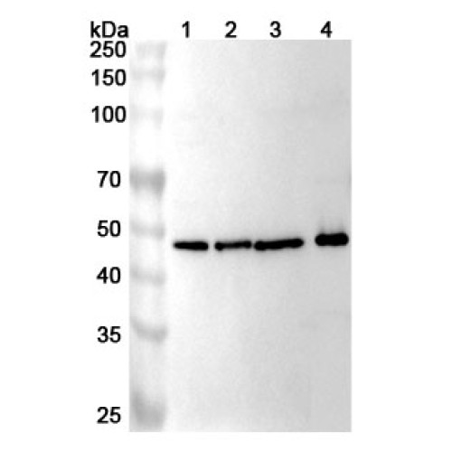 Anti-Human ICA1 Polyclonal Antibody Anti-Human ICA1 Polyclonal Antibody