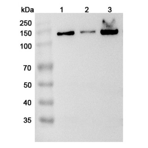 Anti-Human IPO4 Polyclonal Antibody Anti-Human IPO4 Polyclonal Antibody