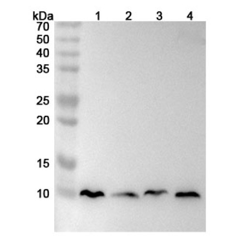 Anti-Human MT-ATP8 Polyclonal Antibody Anti-Human MT-ATP8 Polyclonal Antibody