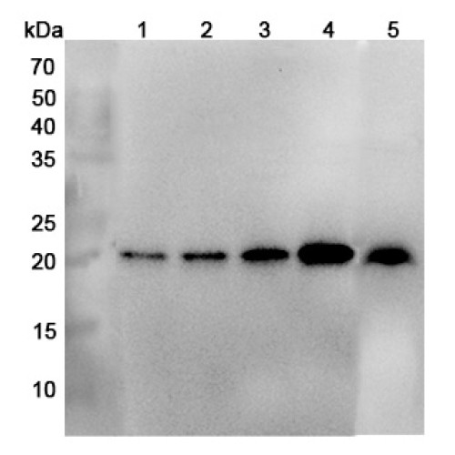 Anti-Human NDUFB10 Polyclonal Antibody Anti-Human NDUFB10 Polyclonal Antibody