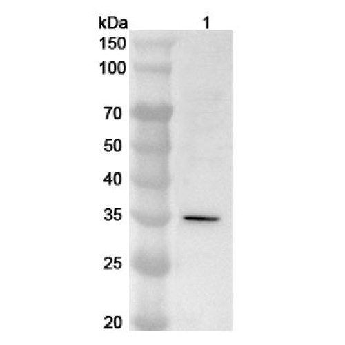 Anti-Human POLR3G Polyclonal Antibody Anti-Human POLR3G Polyclonal Antibody