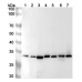 Anti-Human RPA2 Polyclonal Antibody Anti-Human RPA2 Polyclonal Antibody