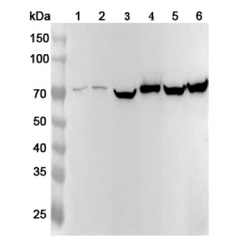 Anti-Human SLC25A12 Polyclonal Antibody Anti-Human SLC25A12 Polyclonal Antibody