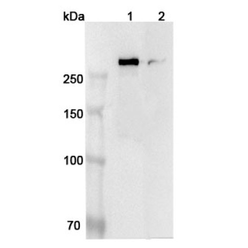 Anti-Human SPTBN1 Polyclonal Antibody Anti-Human SPTBN1 Polyclonal Antibody