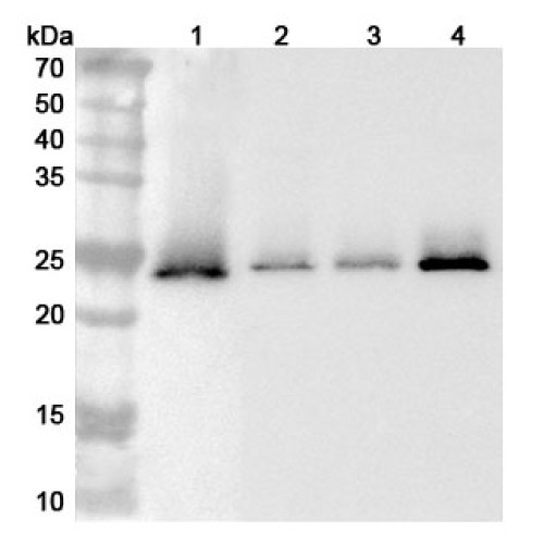 Anti-Human TMED9 Polyclonal Antibody