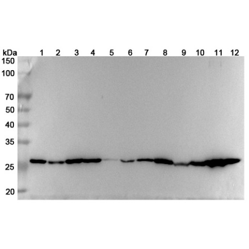 Anti-Human TPI1 Polyclonal Antibody