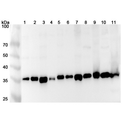 Anti-Human TXNL1 Polyclonal Antibody Anti-Human TXNL1 Polyclonal Antibody