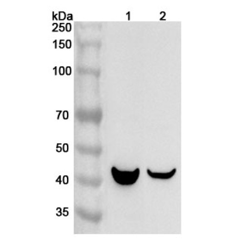 Anti-ORM1/a1AGP Polyclonal Antibody
