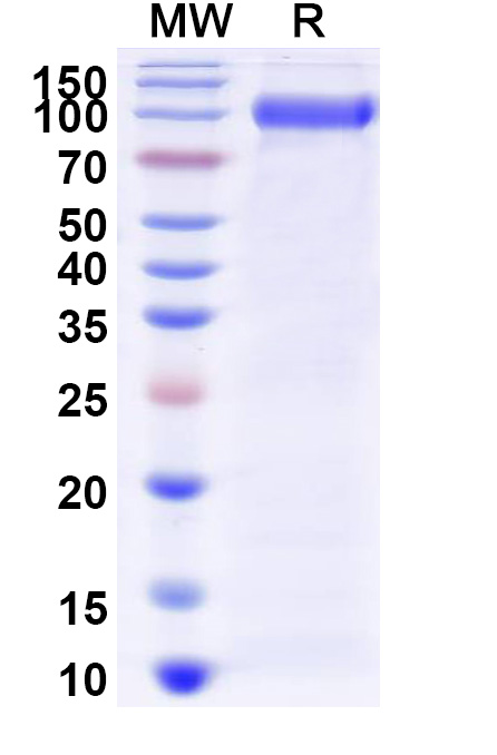 SDS-PAGE analysis for Research Grade Myozyme/Alglucosidase Alfa