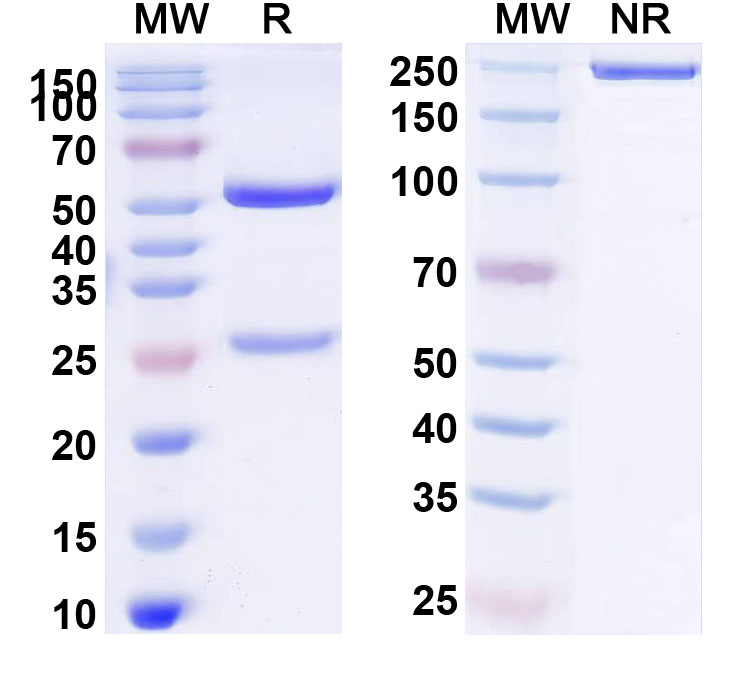 SDS-PAGE for Anti-Human CD167a/DDR1 Antibody (2004#)