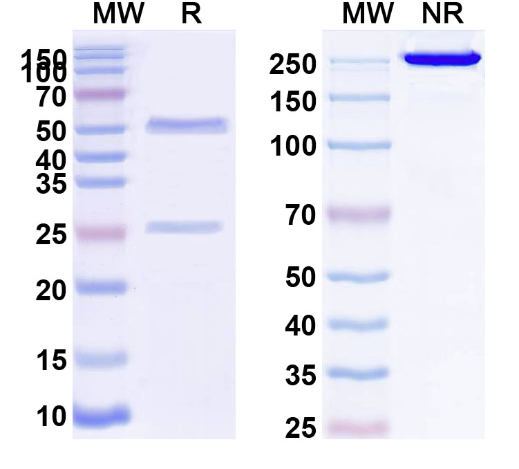 SDS-PAGE for Anti-Human GUCY2C Antibody (SAA0124)