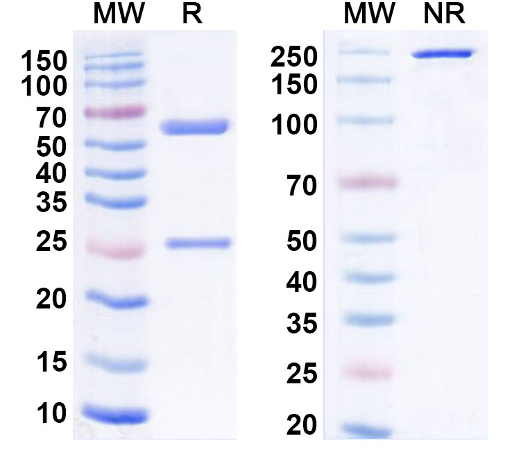 SDS-PAGE for Anti-Human MSLN/Mesothelin Antibody (m912)