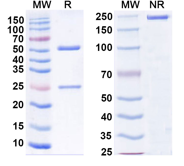 SDS-PAGE for Anti-Mycobacterium tuberculosis acp-1 Antibody (SAA2175)