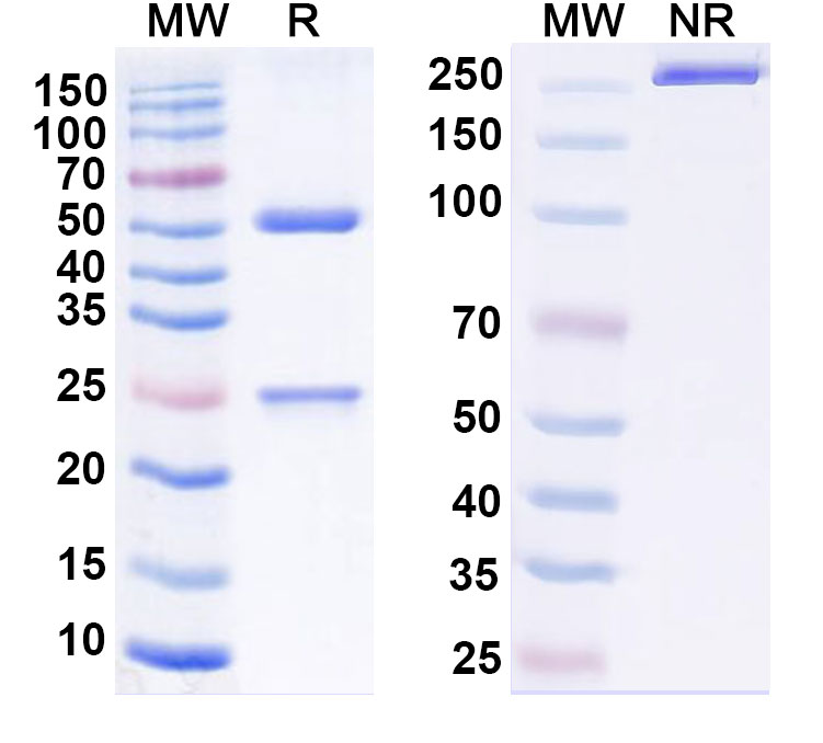 SDS-PAGE for Anti-Mycobacterium tuberculosis pstS1 Antibody (SAA2170)