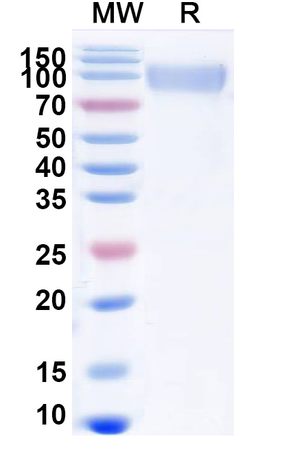 SDS-PAGE for ASFV CD2v/pEP402R/CD2H Recombinant Protein (C-Fc)