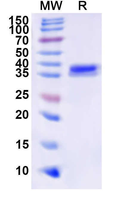 SDS-PAGE for Bacillus cereus gajA Recombinant Protein (N-His)
