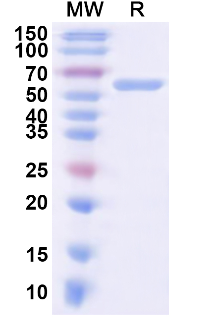 SDS-PAGE for CPV-2 Capsid protein VP2 Recombinant Protein (N-His)