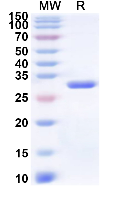 SDS-PAGE for CVA6 VP2/Capsid protein VP2 Recombinant Protein (N-His)