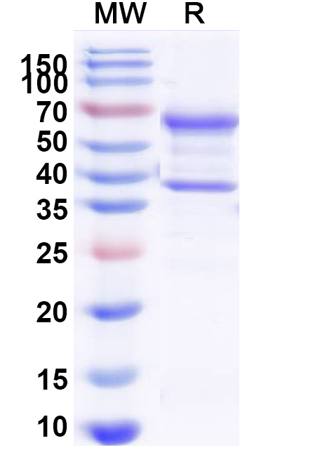 SDS-PAGE for Canine NGF/Beta-NGF Recombinant Protein (C-Fc)