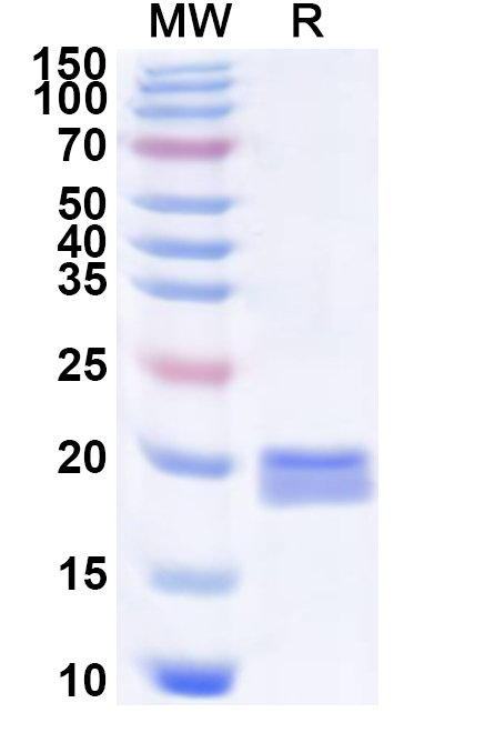 SDS-PAGE for EV71 P2A/Protease 2A Recombinant Protein (N-His)