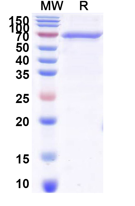 SDS-PAGE for Human AR/Androgen receptor Recombinant Protein (N-His)