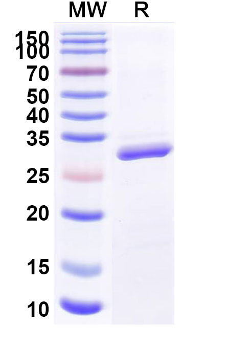 SDS-PAGE for Human BTD Recombinant Protein (N-His)