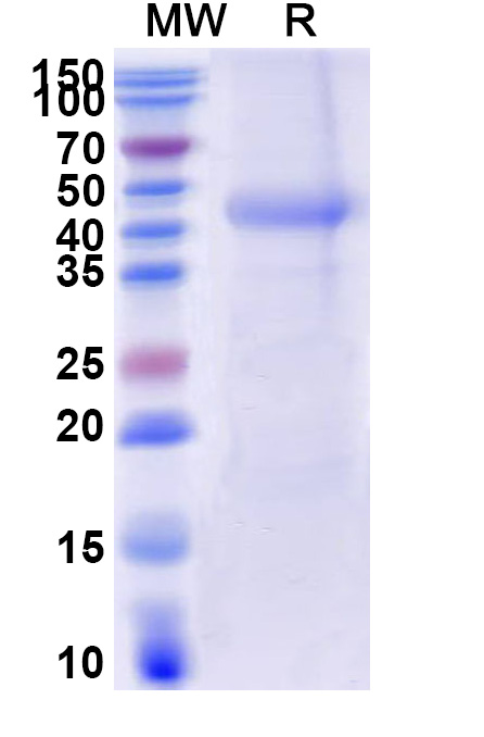 SDS-PAGE for Human CD116/CSF2RA Recombinant Protein (C-His)