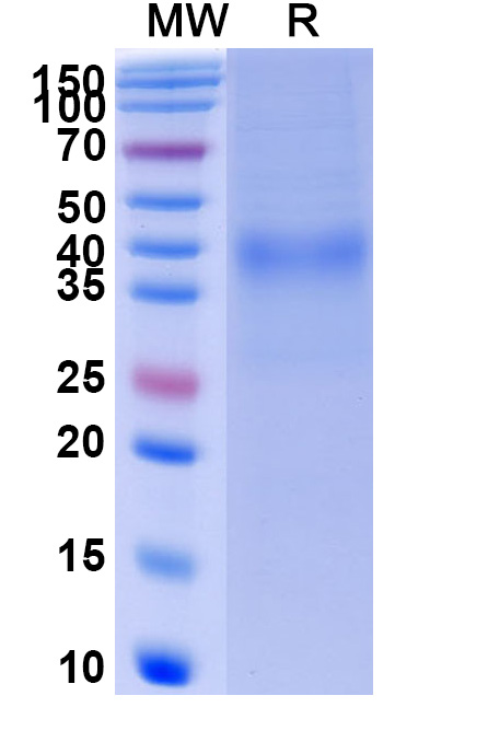 SDS-PAGE for Human CD158d/KIR2DL4 Recombinant Protein (C-His)