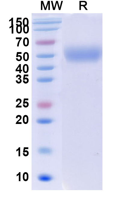 SDS-PAGE for Human CD172b/SIRPB1 Recombinant Protein (C-His)