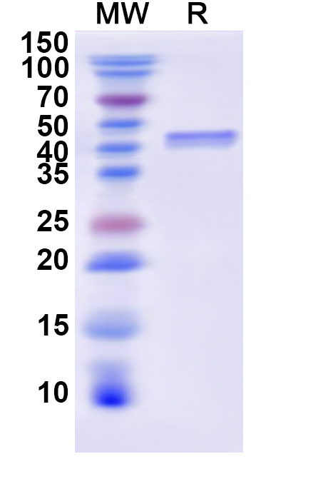 SDS-PAGE for Human CD25/IL2RA Recombinant Protein (N-His-KSI)