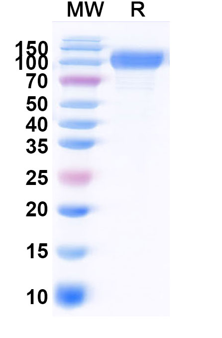 SDS-PAGE for Human CD29/ITGB1 Recombinant Protein (C-His)