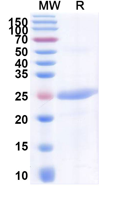 SDS-PAGE for Human CD319/SLAMF7 Recombinant Protein (N-His)