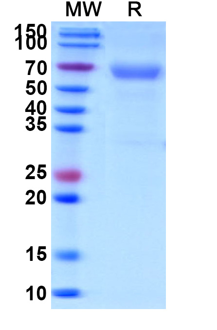 SDS-PAGE for Human CD320 Recombinant Protein (C-Fc)