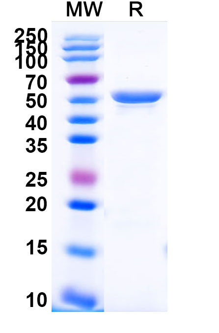 SDS-PAGE for Human CD49f/ITGA6 Recombinant Protein (N-His)