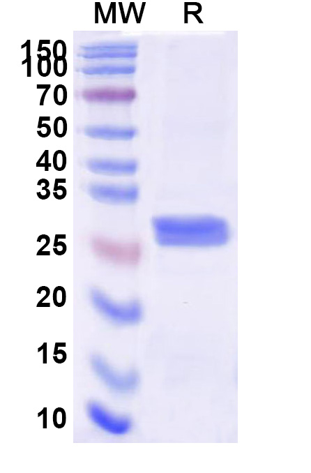 SDS-PAGE for Human CFD Recombinant Protein (C-His)