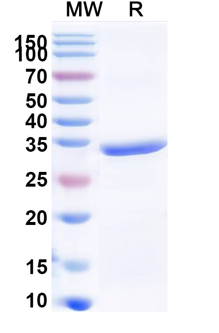 SDS-PAGE for Human COL1A2 Recombinant Protein (N-His)