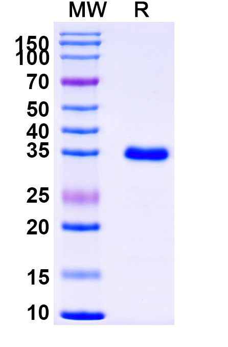 SDS-PAGE for Human DNMT3A Recombinant Protein (N-His)