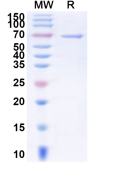SDS-PAGE for Human DSG3 Recombinant Protein (C-His)