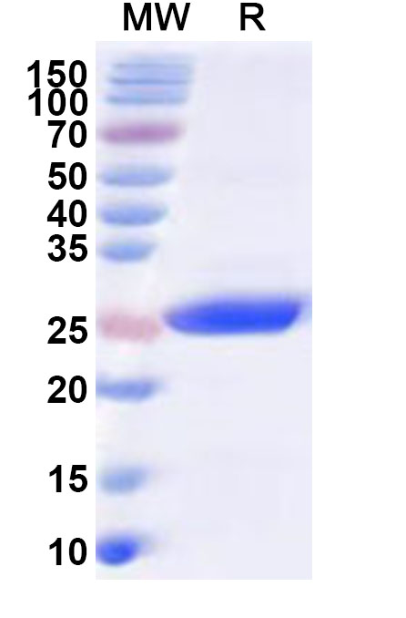 SDS-PAGE for Human DSP Recombinant Protein (N-His)
